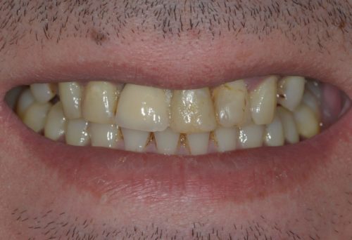 Before image