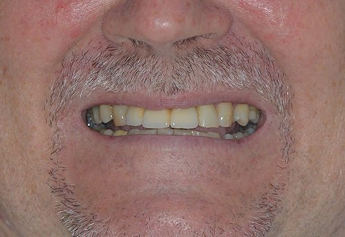 After image