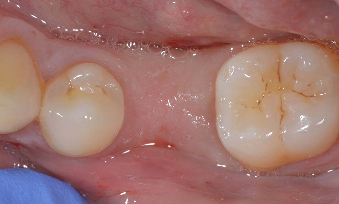 Before image