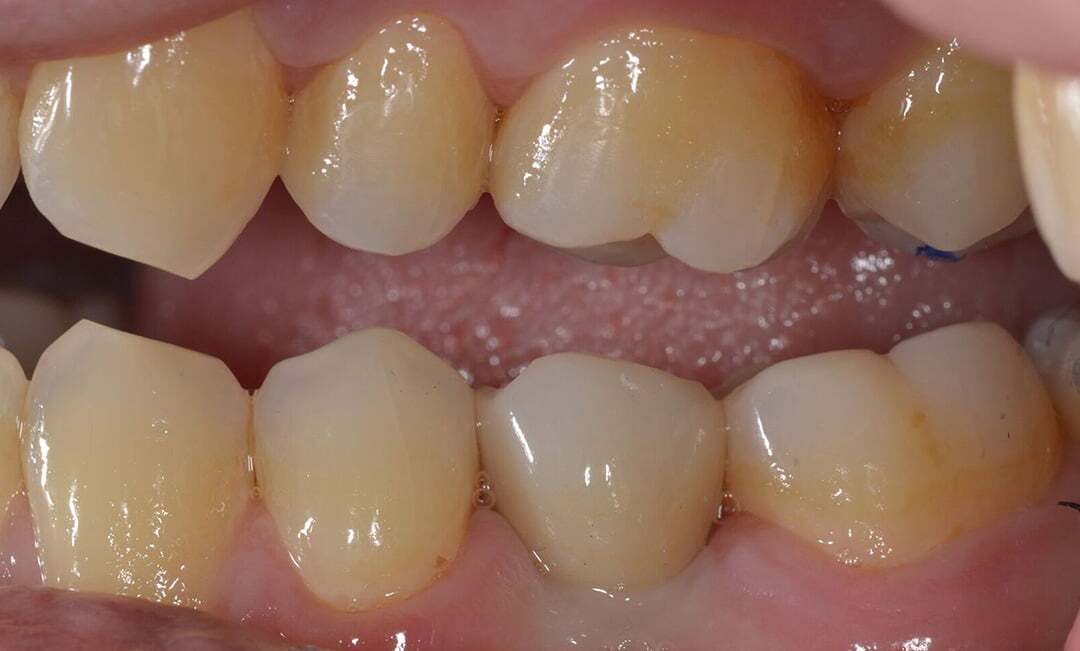 After image