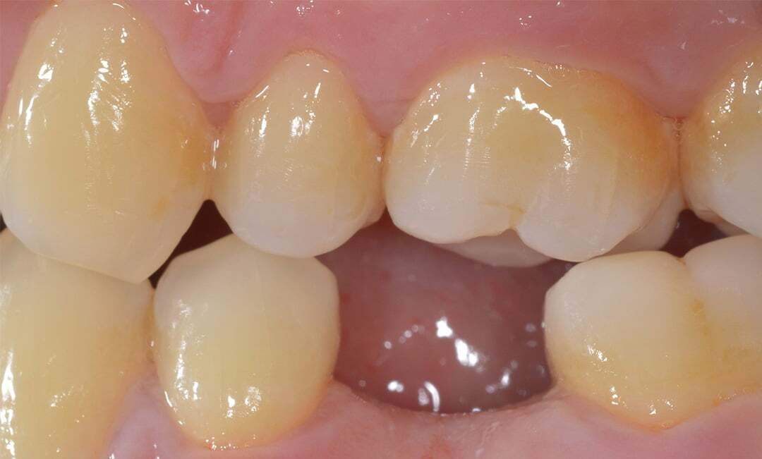 Before image