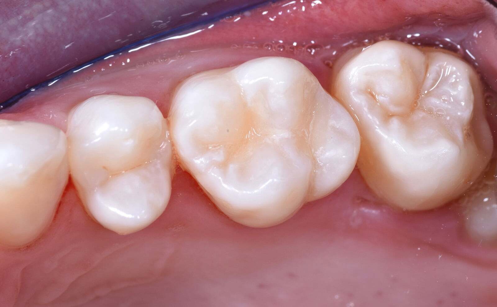After image