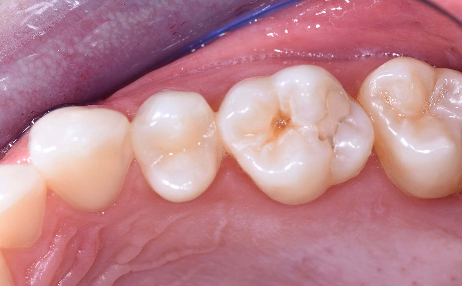 Before image