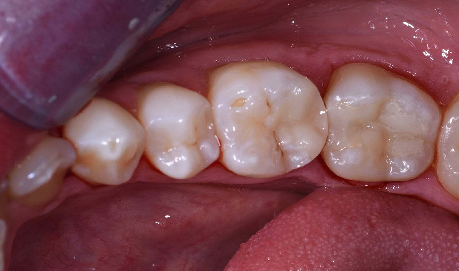 After image