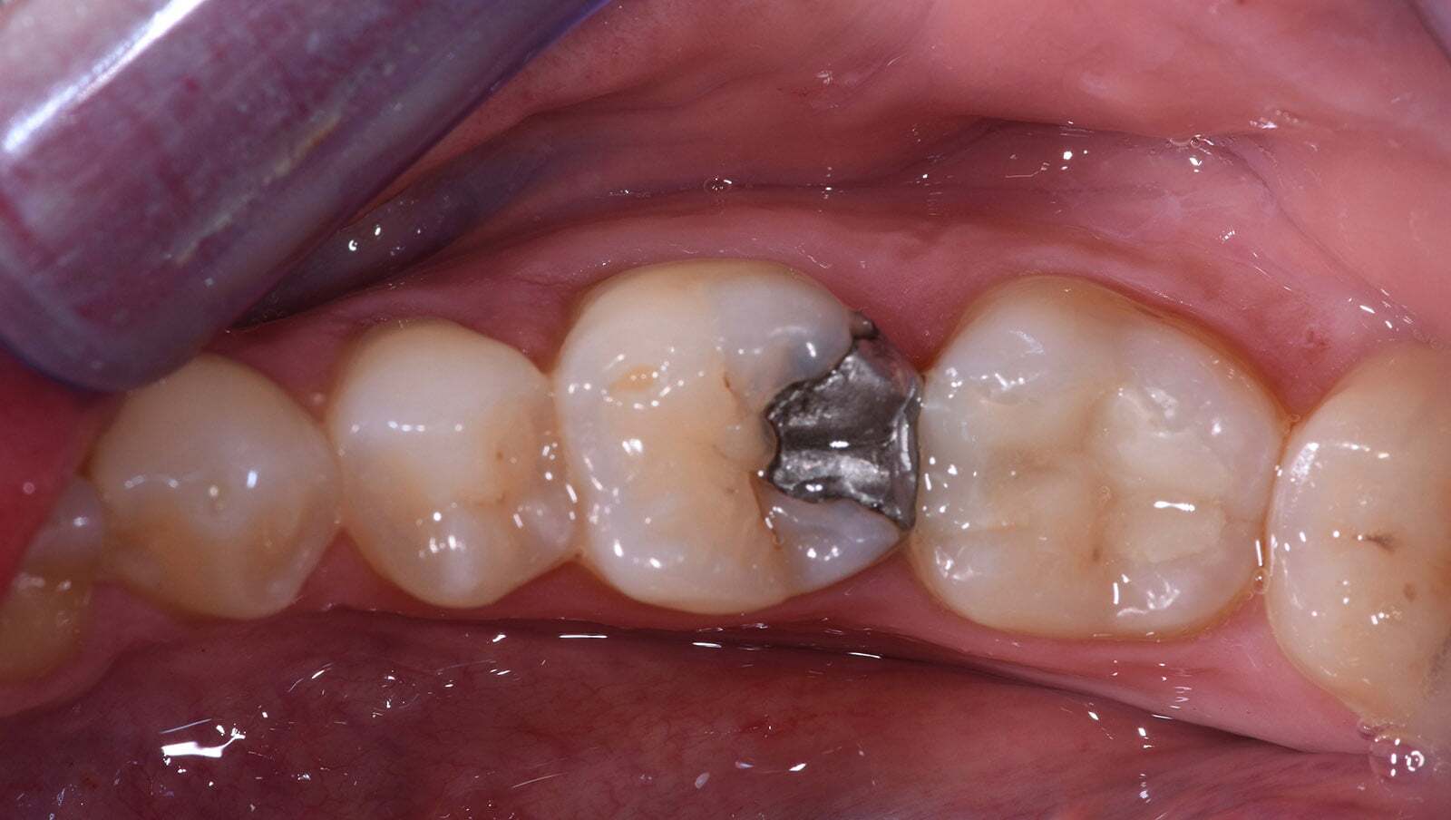 Before image