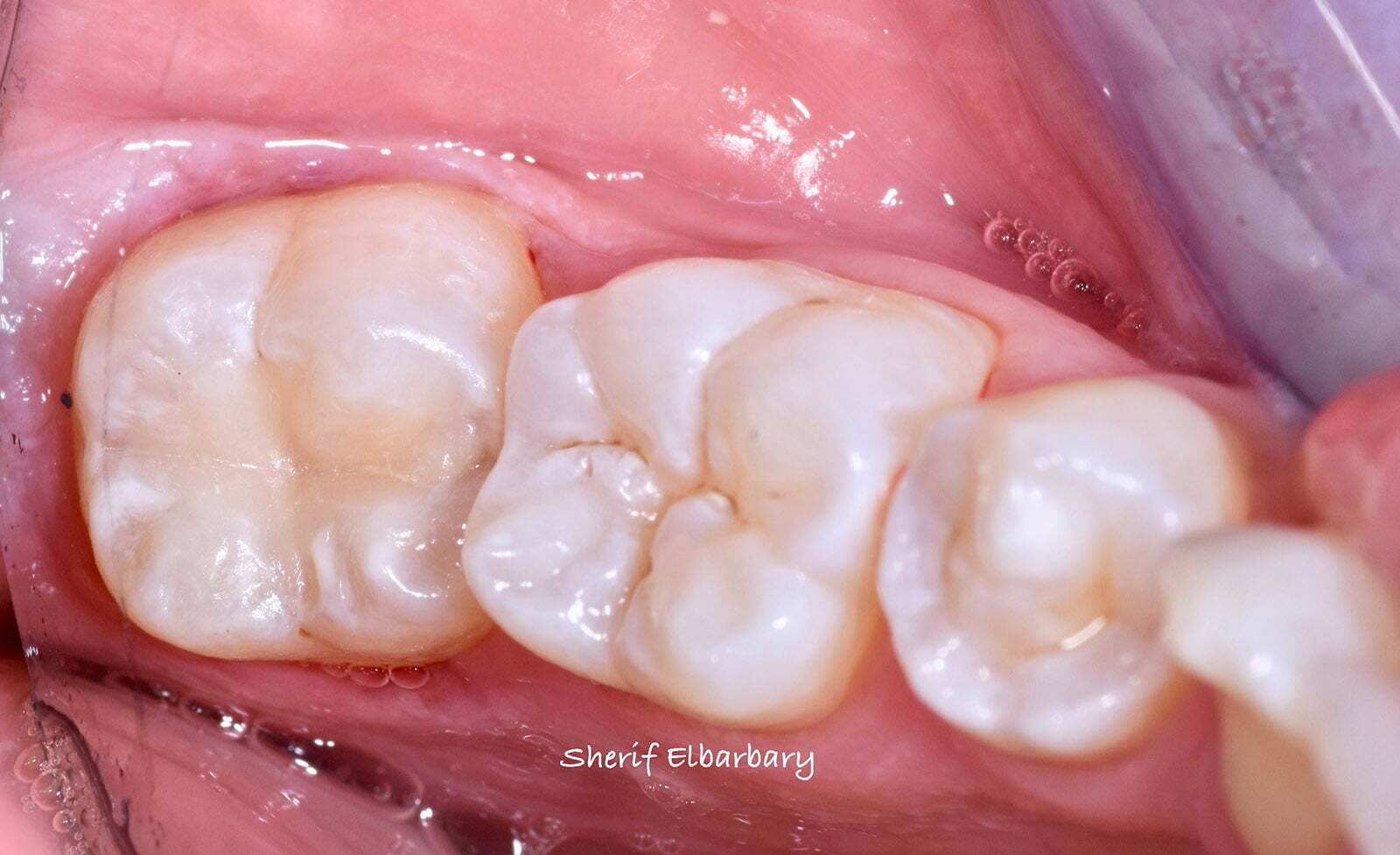 After image