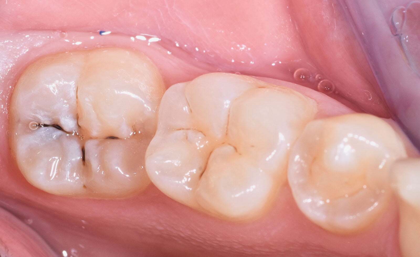 Before image
